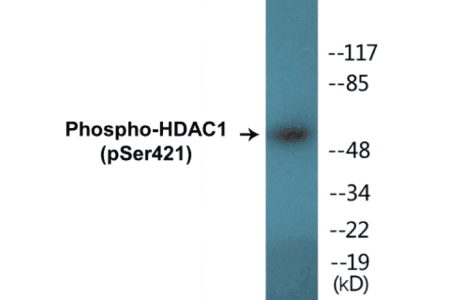 Western Blot - HDAC1 (phospho Ser421) Cell Based ELISA Kit (CBP1302) - Antibodies.com