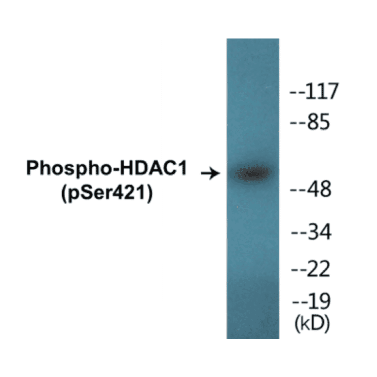 Western Blot - HDAC1 (phospho Ser421) Cell Based ELISA Kit (CBP1302) - Antibodies.com