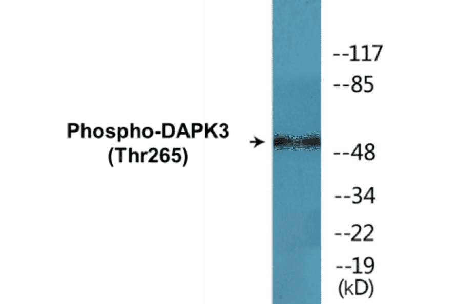Western Blot - DAPK3 (phospho Thr265) Cell Based ELISA Kit (CBP1360) - Antibodies.com