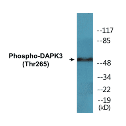 Western Blot - DAPK3 (phospho Thr265) Cell Based ELISA Kit (CBP1360) - Antibodies.com