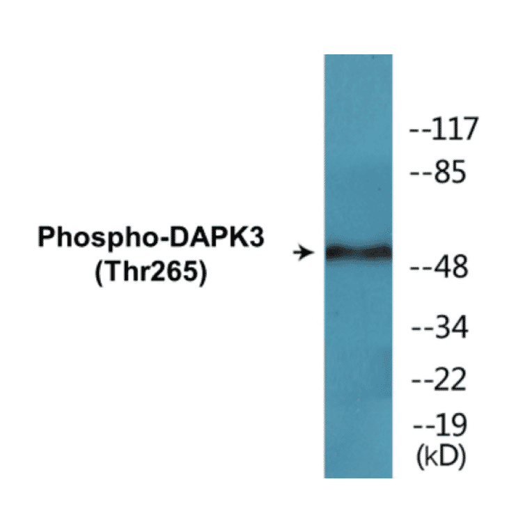 Western Blot - DAPK3 (phospho Thr265) Cell Based ELISA Kit (CBP1360) - Antibodies.com