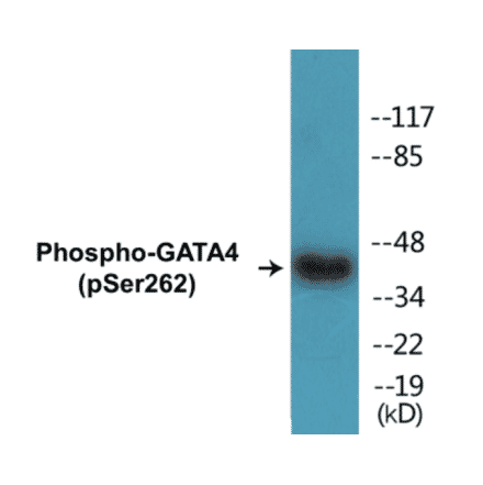 Western Blot - GATA4 (phospho Ser262) Cell Based ELISA Kit (CBP1375) - Antibodies.com