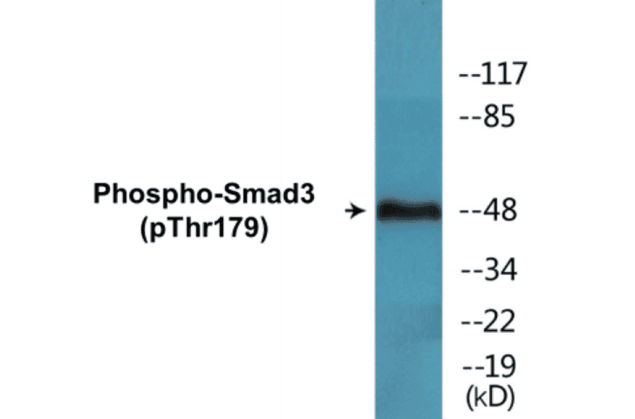 Western Blot - Smad3 (phospho Thr179) Cell Based ELISA Kit (CBP1394) - Antibodies.com