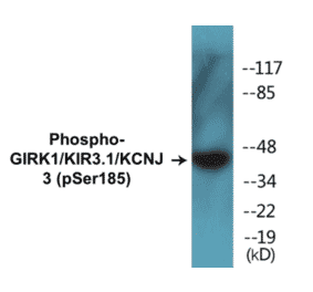Western Blot - GIRK1 (phospho Ser185) Cell Based ELISA Kit (CBP1405) - Antibodies.com