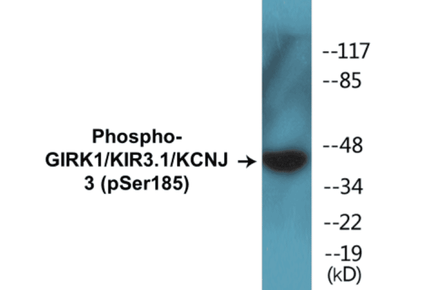 Western Blot - GIRK1 (phospho Ser185) Cell Based ELISA Kit (CBP1405) - Antibodies.com