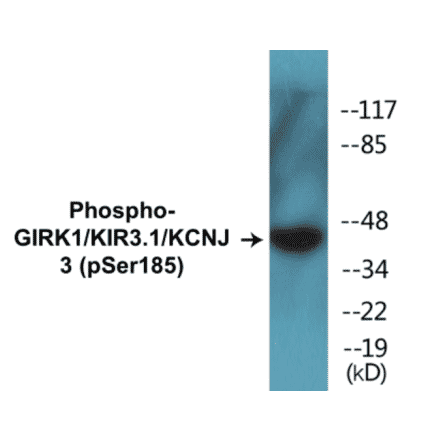 Western Blot - GIRK1 (phospho Ser185) Cell Based ELISA Kit (CBP1405) - Antibodies.com