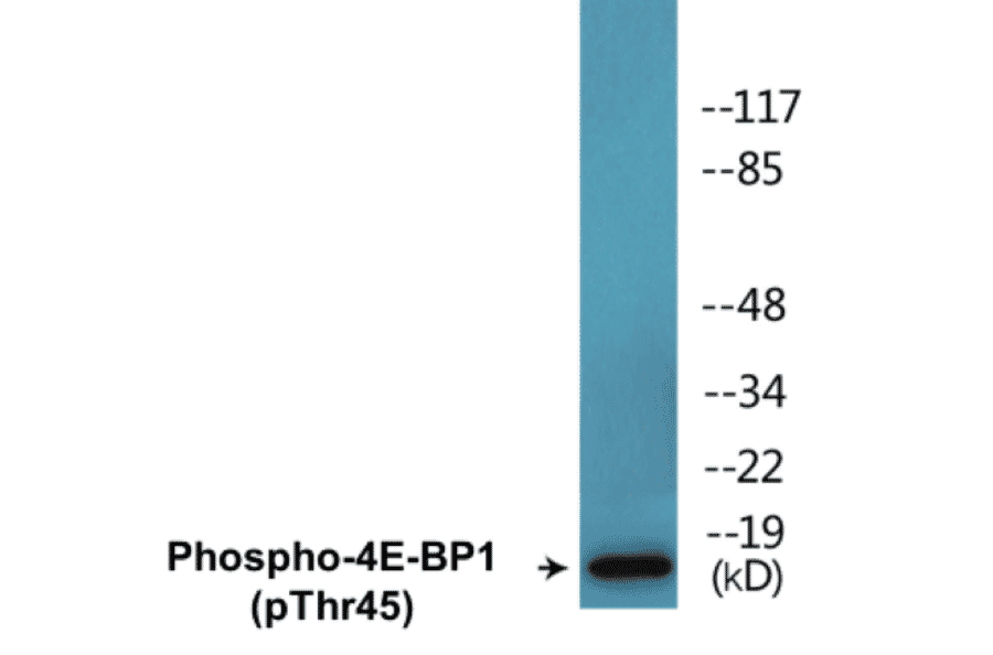 Western Blot - 4E-BP1 (phospho Thr45) Cell Based ELISA Kit (CBP1488) - Antibodies.com
