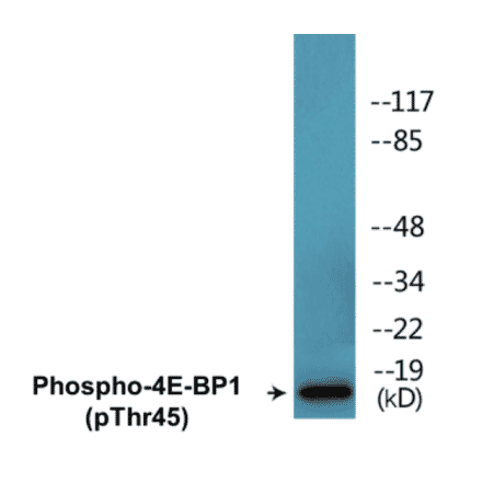 Western Blot - 4E-BP1 (phospho Thr45) Cell Based ELISA Kit (CBP1488) - Antibodies.com