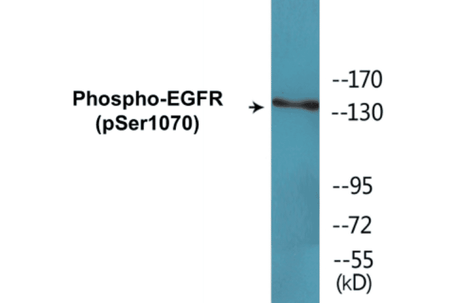Western Blot - EGFR (phospho Ser1070) Cell Based ELISA Kit (CBP1532) - Antibodies.com