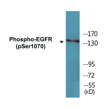 Western Blot - EGFR (phospho Ser1070) Cell Based ELISA Kit (CBP1532) - Antibodies.com