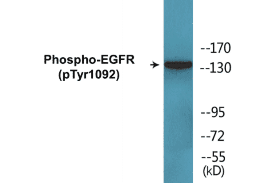 Western Blot - EGFR (phospho Tyr1092) Cell Based ELISA Kit (CBP1533) - Antibodies.com