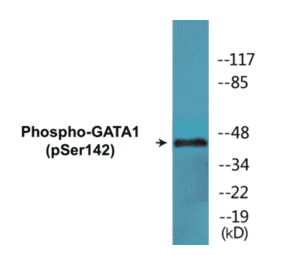 Western Blot - GATA1 (phospho Ser142) Cell Based ELISA Kit (CBP1562) - Antibodies.com