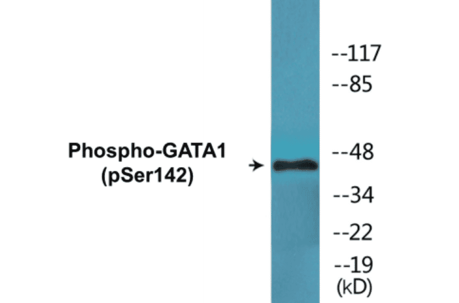 Western Blot - GATA1 (phospho Ser142) Cell Based ELISA Kit (CBP1562) - Antibodies.com