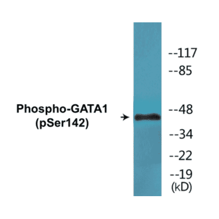 Western Blot - GATA1 (phospho Ser142) Cell Based ELISA Kit (CBP1562) - Antibodies.com