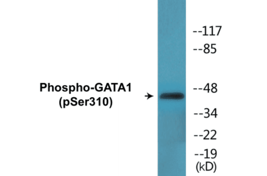 Western Blot - GATA1 (phospho Ser310) Cell Based ELISA Kit (CBP1563) - Antibodies.com