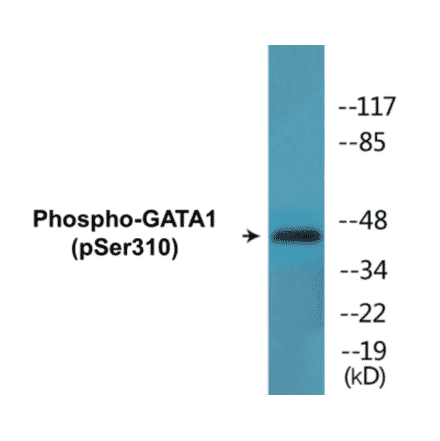 Western Blot - GATA1 (phospho Ser310) Cell Based ELISA Kit (CBP1563) - Antibodies.com