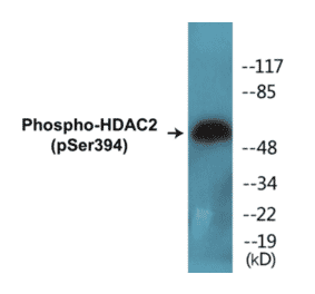 Western Blot - HDAC2 (phospho Ser394) Cell Based ELISA Kit (CBP1568) - Antibodies.com