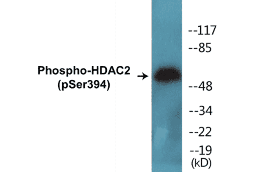 Western Blot - HDAC2 (phospho Ser394) Cell Based ELISA Kit (CBP1568) - Antibodies.com