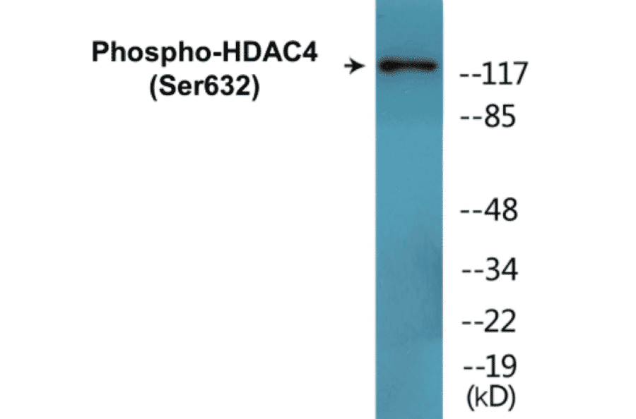 Western Blot - HDAC4 (phospho Ser632) Cell Based ELISA Kit (CBP1569) - Antibodies.com