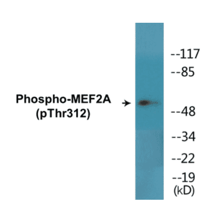 Western Blot - MEF2A (phospho Thr312) Cell Based ELISA Kit (CBP1608) - Antibodies.com
