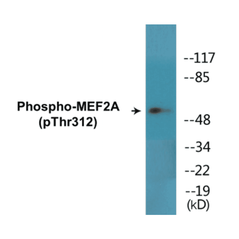 Western Blot - MEF2A (phospho Thr312) Cell Based ELISA Kit (CBP1608) - Antibodies.com