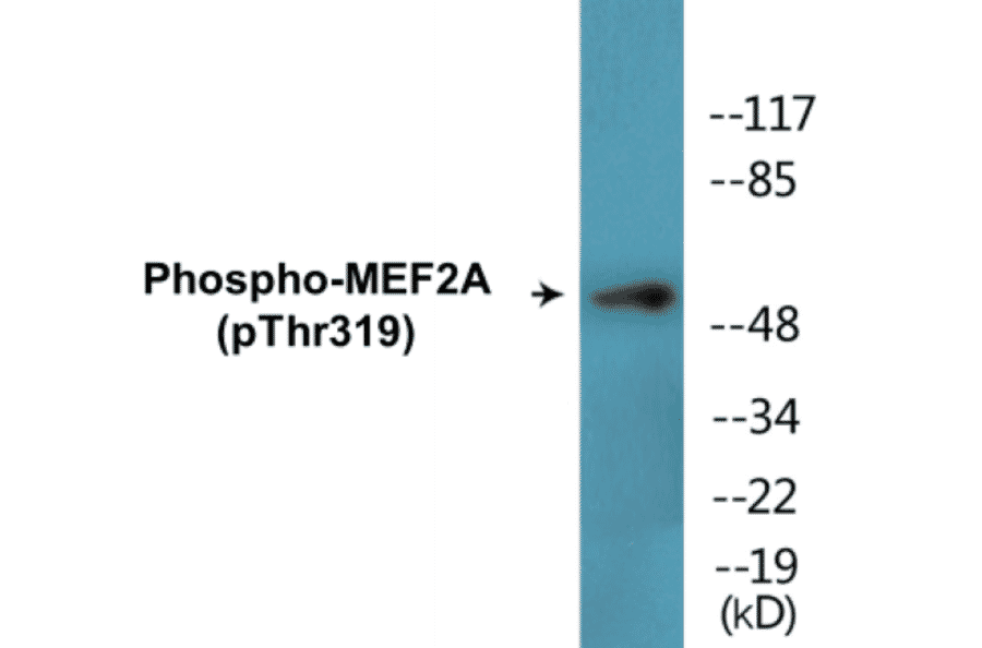 Western Blot - MEF2A (phospho Thr319) Cell Based ELISA Kit (CBP1609) - Antibodies.com