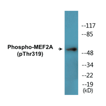 Western Blot - MEF2A (phospho Thr319) Cell Based ELISA Kit (CBP1609) - Antibodies.com