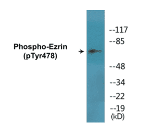 Western Blot - Ezrin (phospho Tyr478) Cell Based ELISA Kit (CBP1720) - Antibodies.com