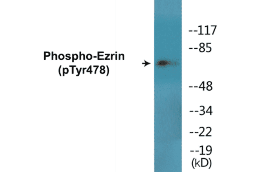 Western Blot - Ezrin (phospho Tyr478) Cell Based ELISA Kit (CBP1720) - Antibodies.com