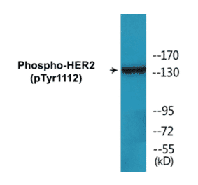 Western Blot - HER2 (phospho Tyr1112) Cell Based ELISA Kit (CBP1724) - Antibodies.com