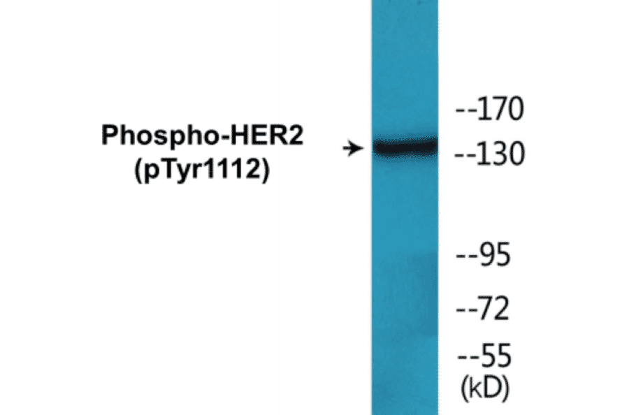 Western Blot - HER2 (phospho Tyr1112) Cell Based ELISA Kit (CBP1724) - Antibodies.com
