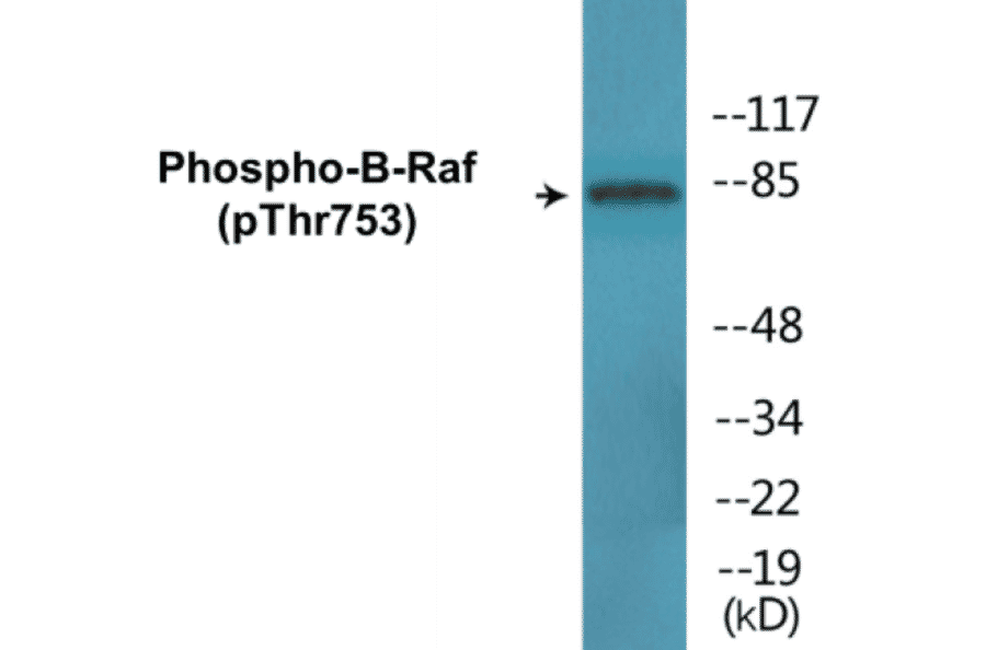 Western Blot - B-Raf (phospho Thr753) Cell Based ELISA Kit (CBP1809) - Antibodies.com