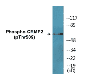 Western Blot - CRMP2 (phospho Thr509) Cell Based ELISA Kit (CBP1815) - Antibodies.com