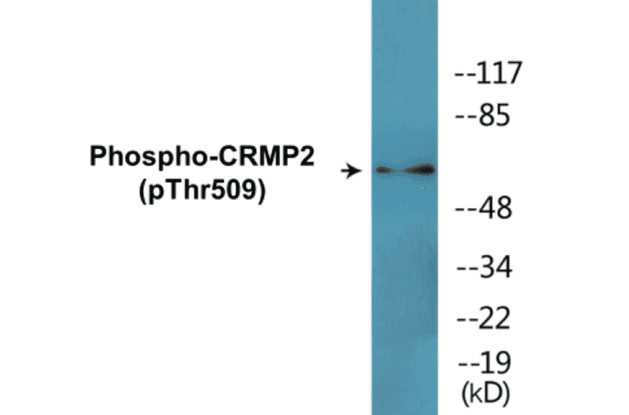 Western Blot - CRMP2 (phospho Thr509) Cell Based ELISA Kit (CBP1815) - Antibodies.com