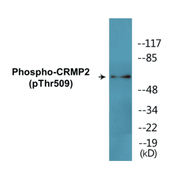 Western Blot - CRMP2 (phospho Thr509) Cell Based ELISA Kit (CBP1815) - Antibodies.com