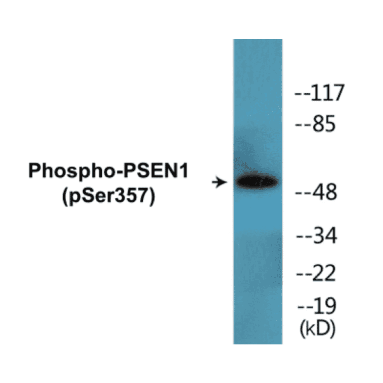 Western Blot - PSEN1 (phospho Ser357) Cell Based ELISA Kit (CBP1835) - Antibodies.com