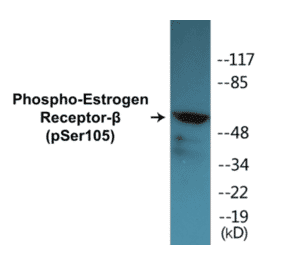 Western Blot - Estrogen Receptor beta (phospho Ser105) Cell Based ELISA Kit (CBP1371) - Antibodies.com