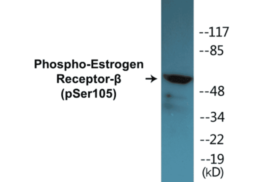 Western Blot - Estrogen Receptor beta (phospho Ser105) Cell Based ELISA Kit (CBP1371) - Antibodies.com