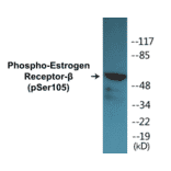 Western Blot - Estrogen Receptor beta (phospho Ser105) Cell Based ELISA Kit (CBP1371) - Antibodies.com