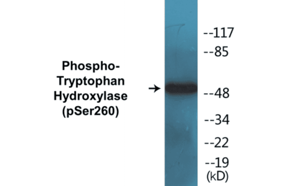Western Blot - Tryptophan Hydroxylase (phospho Ser260) Cell Based ELISA Kit (CBP1400) - Antibodies.com