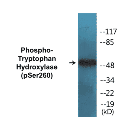 Western Blot - Tryptophan Hydroxylase (phospho Ser260) Cell Based ELISA Kit (CBP1400) - Antibodies.com