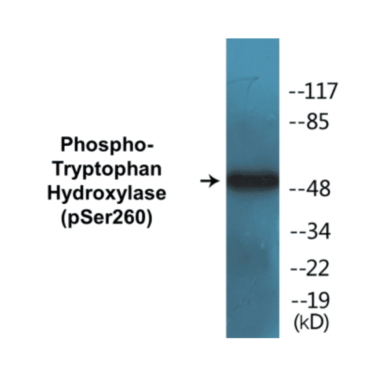 Western Blot - Tryptophan Hydroxylase (phospho Ser260) Cell Based ELISA Kit (CBP1400) - Antibodies.com