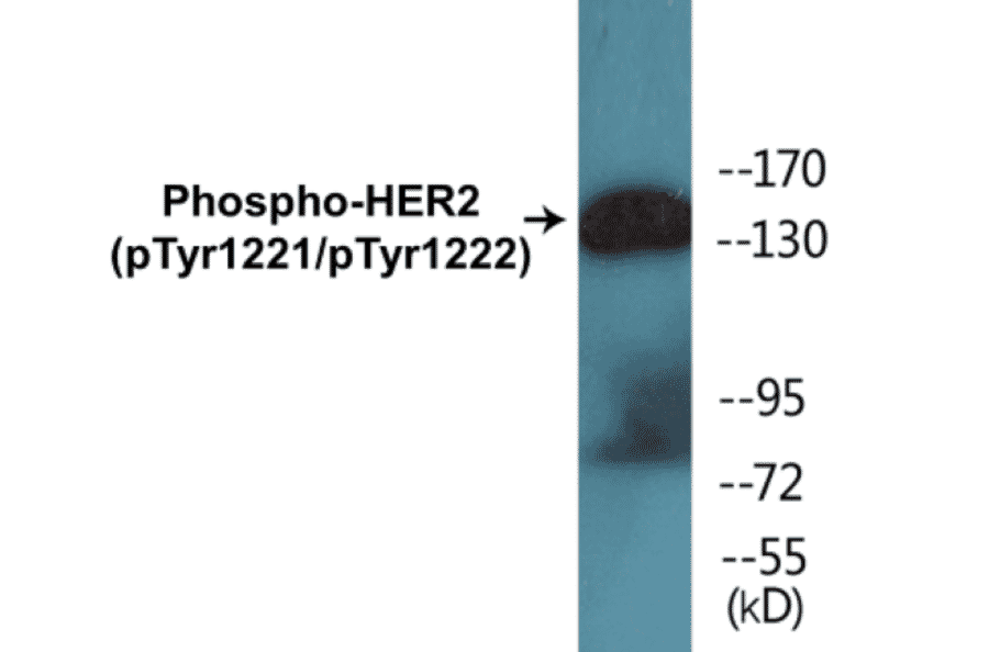 Western Blot - HER2 (phospho Tyr1221 + Tyr1222) Cell Based ELISA Kit (CBP1572) - Antibodies.com