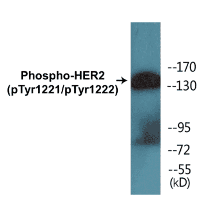 Western Blot - HER2 (phospho Tyr1221 + Tyr1222) Cell Based ELISA Kit (CBP1572) - Antibodies.com