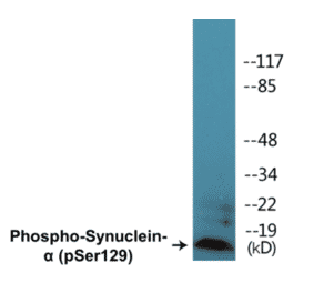 Western Blot - alpha Synuclein (phospho Ser129) Cell Based ELISA Kit (CBP1221) - Antibodies.com