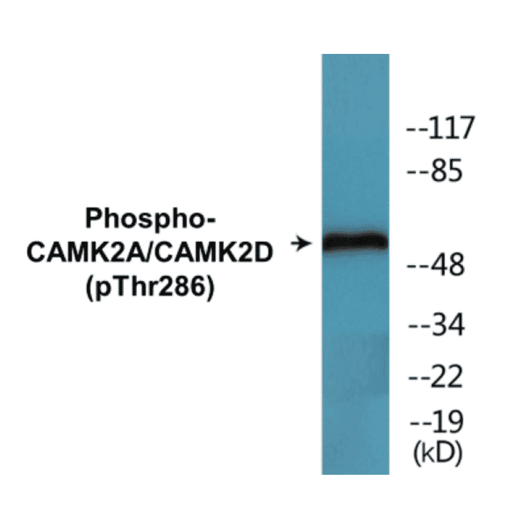 Western Blot - CAMK2A + CAMK2D (phospho Thr286) Cell Based ELISA Kit (CBP1509) - Antibodies.com