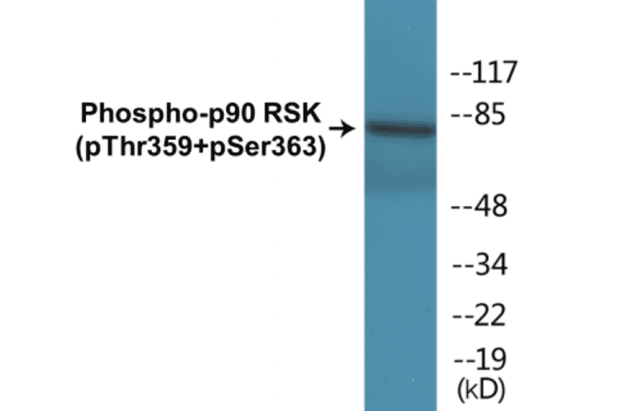 Western Blot - p90RSK (phospho Thr359 + Ser363) Cell Based ELISA Kit (CBP1193) - Antibodies.com
