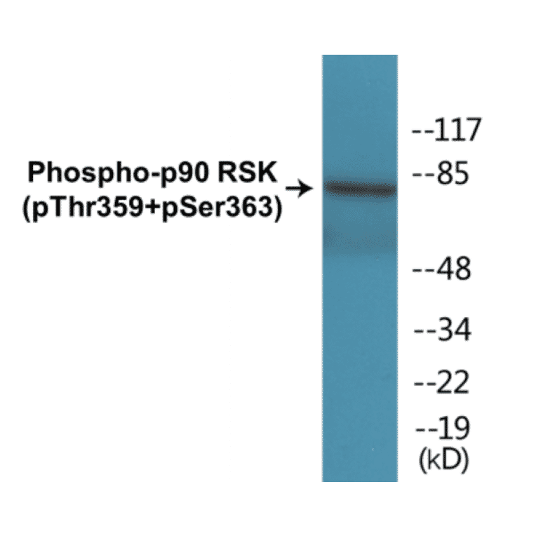 Western Blot - p90RSK (phospho Thr359 + Ser363) Cell Based ELISA Kit (CBP1193) - Antibodies.com