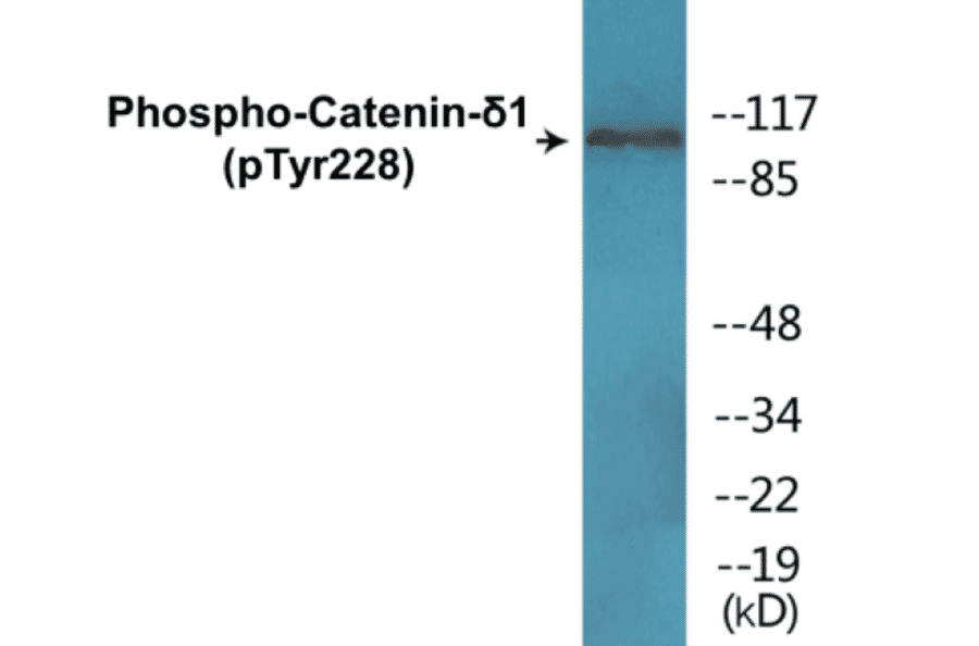 Western Blot - Catenin delta 1 (phospho Tyr228) Cell Based ELISA Kit (CBP1356) - Antibodies.com