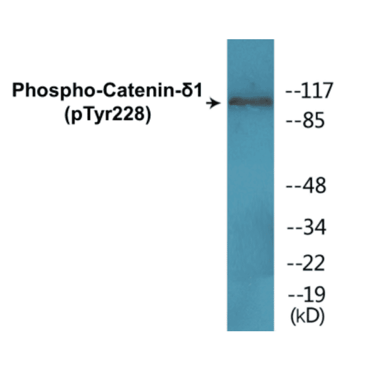 Western Blot - Catenin delta 1 (phospho Tyr228) Cell Based ELISA Kit (CBP1356) - Antibodies.com